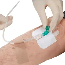 10 Curativo Filme Com Fenestra Fixar Colar Cateter Venoso Foto mini 4