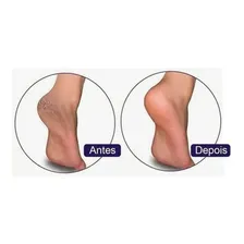 3 Cremes Spa Acaba Com Rachaduras Nos Pés Com Ureia Foto mini 4