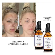 Acido Hialurônico + Vitamina C Pura - Clareador E Anti Idade Tipo de pele Todas Foto mini  2
