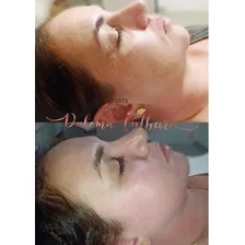 Ácido Retinóico 10% - Peeling Clareador Rejuvenescedor Foto mini  3