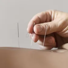 Agulha De Acupuntura 0,25x30 Sistêmica Caixa Com 1000 Un Foto mini 4