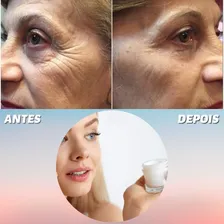 Antirugas Efeito Botox Creme Rosto Ácido Hialurônico Foto mini 4
