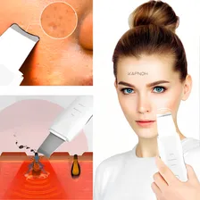 Aparelho Peeling Ultrasônico C/ Ionização Tira Cravos 2 Em 1 Foto mini 3