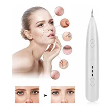 Caneta Laser Jato Plasma Removedora Tatuagem Machas Na Pele Foto mini 4