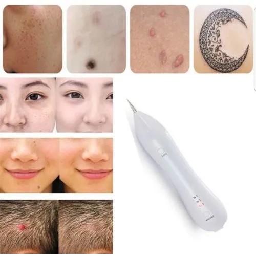 Caneta Laser Jato Plasma Removedora Tatuagem Machas Na Pele Foto 1