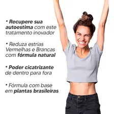 Cicatrissim - Creme Hidratante Redutor De Estrias 150g Foto mini  3