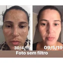 Clareador Facial Higpele Higpele Foto mini 4