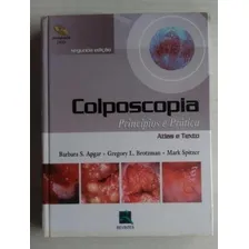 Colposcopia - PrincĂpios E Prática Foto mini 1