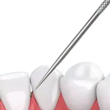 Conjunto De 7 Peças Aço Inoxidável Para Fio Dental Foto mini 4