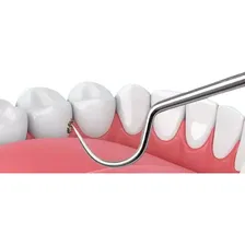 Conjunto De 7 Peças Aço Inoxidável Para Fio Dental Foto mini 3
