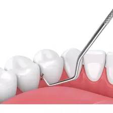 Conjunto De 7 Peças Aço Inoxidável Para Fio Dental Foto mini 2