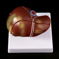 Corpo Humano Órgão Modelo Fígado Anatomia Foto mini 4