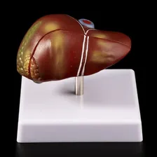 Corpo Humano Órgão Modelo Fígado Anatomia Foto mini  2