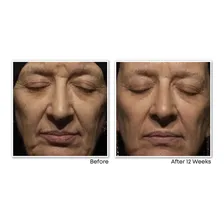 Creme Deep Wrinkle Night Cream RoC Retinol Correxion noite de 30mL Foto mini 4