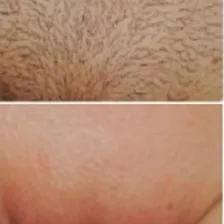 Creme Depilatório Partes Intimas Avon Depilador Depilação Foto mini 2