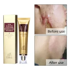Creme Ginseng Lambena -removedor Cicatrizes, Acnes E Estrias Foto mini 2