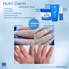 Creme Hidratante Nutri Derm 500g - Com Uréia, Sem. De Uva E+ Tipo De Embalagem Pote Fragrância Suave Tipos De Pele Para Todos Os Tipos De Pele Foto mini  2