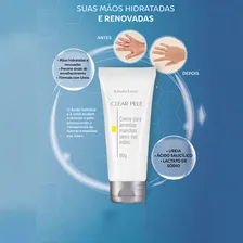 Creme Para Amenizar Marcas Senis Nas Mãos - Abelha Rainha Foto mini 4