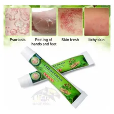 Creme Pomada Psoriase Coceira Alergia Eczema Dermatite Foto mini  3