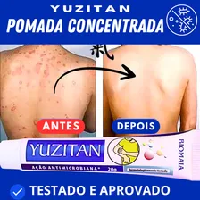 Creme PsorÃase Dermatite Alergia Coceira Com Vermelhidão Foto mini 4