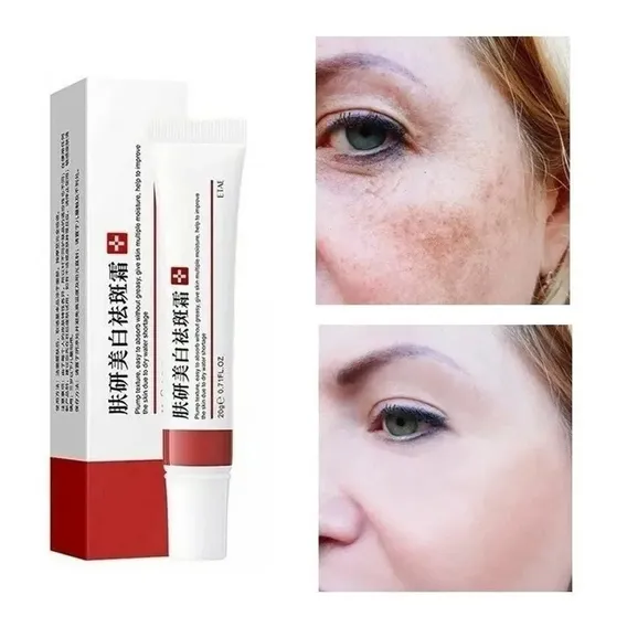 Creme Removedor Melasma Manchas Sardas Tipo de pele Todo tipo de pele Foto 1