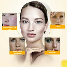 Creme Removedor Melasma Manchas Sardas Tipo de pele Todo tipo de pele Foto mini  3
