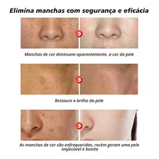 Creme Removedor Melasma Manchas Sardas Tipo de pele Todo tipo de pele Foto mini 4