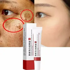 Creme Removedor Melasma Manchas Sardas Tipo de pele Todo tipo de pele Foto mini  2
