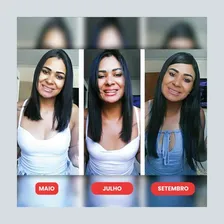 Cresce Cabelo Extrato De Priorin - T么nico Cresce Pelo Foto mini 4
