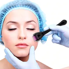 Dermaroller 540 Agulhas Derma Roller System Foto mini 3