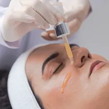 Dermolight Tranex Peel Peeling Químico 30g Extratos Da Terra Todo tipo de pele Foto mini  3