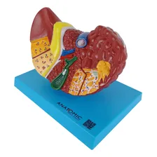 FĂgado Com Patologia Foto mini 4