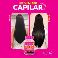 Forever Liss 3 Unidades Forever Hair Crescimento Capilar 30d Foto mini 4
