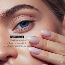 Gel Secativo Para Acne Rapid Clear 15g Neutrogena Fragrância Lavanda Tipo de embalagem Pote Foto mini 4