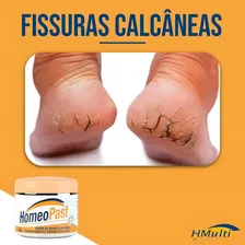 Homeopast Creme Hidratante Ultra Hidratação (30g) Foto mini  2