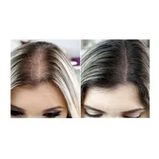 Imecap Hair 60 Cápsulas 1 Caixas Original Foto mini 4