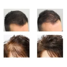 Instant Hair Plus Castanho Médio 300ml Foto mini 2