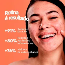Kit 2 Gel Secativo Antiacne Espinhas Rosto Acnezil 10g Cimed Foto mini 3