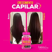 Kit 3 Meses Forever Hair Crescimento Capilar - Forever Liss Foto mini 3