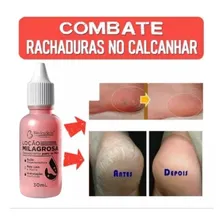 Kit 36 Gota Milagrosa Anti Ressecamento Hidratante Atacado Foto mini  3