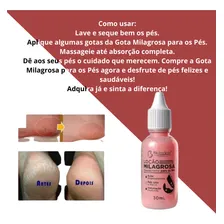 Kit 36 Gota Milagrosa Anti Ressecamento Hidratante Atacado Foto mini  2