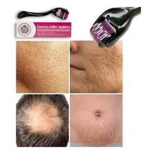 Kit 5 Dermaroller System Rolinho 540 Microagulha Pele Barba Foto mini 4