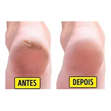 Kit 6unidades Loção Hidratante Pé Feito Antiressecamento 50g Foto mini 3