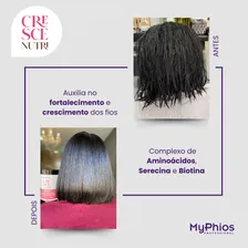 Kit Completo Cresce Nutri - Myphios Foto mini  2