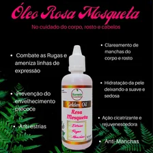 Kit Gel De Babosa Óleo De Rosa Mosqueta Hidrata/tira Manchas Foto mini  3