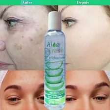 Kit Gel De Babosa Óleo De Rosa Mosqueta Hidrata/tira Manchas Foto mini 4
