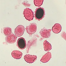 Lâminas Para Microscópio Preparadas De Parasitologia 30peças Foto mini  2