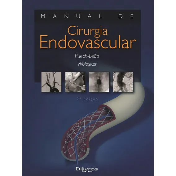 Livro: Manual De Cirurgia Endovascular Foto 1