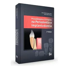 Livro Procedimentos Cirúrgicos Na Periodontia E Implantodont Foto mini 1