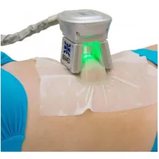 Manta Anticongelante Allcare Rmc Para Criolip贸lise Tamanho M Foto mini 2